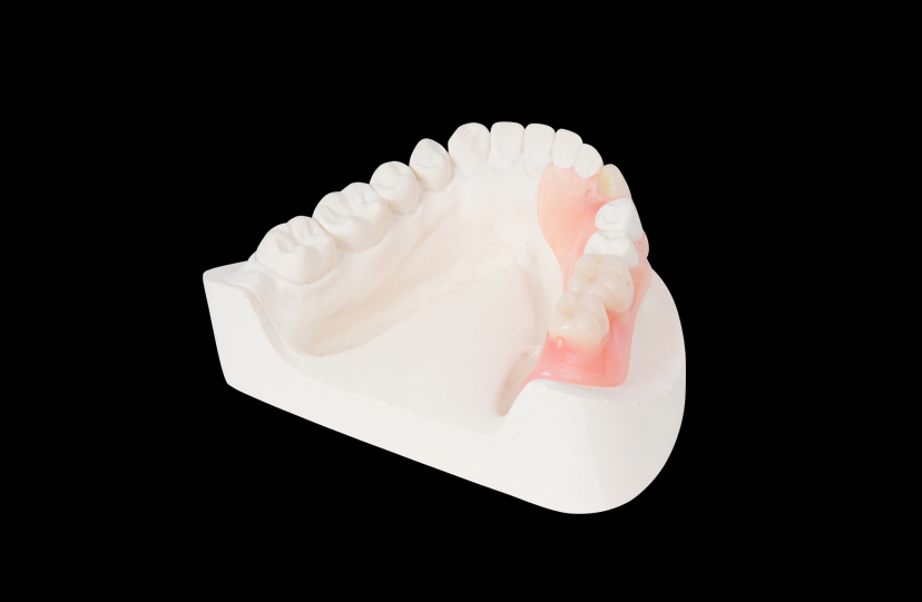 Thermoplastic Partial